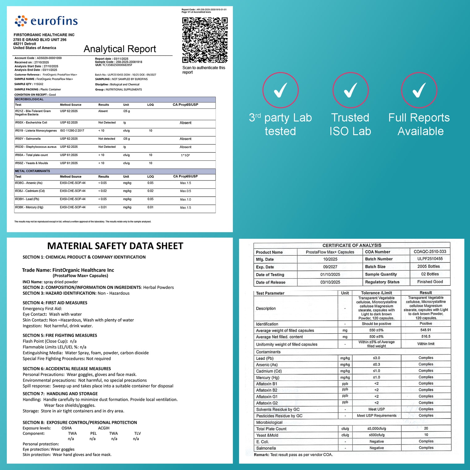 Men’s Prostate Health & Urinary Flow Support with Saw Palmetto, Stinging Nettle & Beta-Sitosterol | Supports Prostate Size & Comfort | Third-Party Tested, Vegan, Non-GMO, Gluten-Free, 120 Capsules